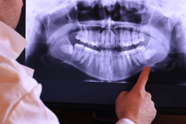 Best Emergency TMJ Treatment in Eggertsville, NY