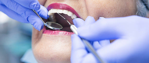 Best Urgent Care for Lost Fillings or Crowns in Eggertsville, NY